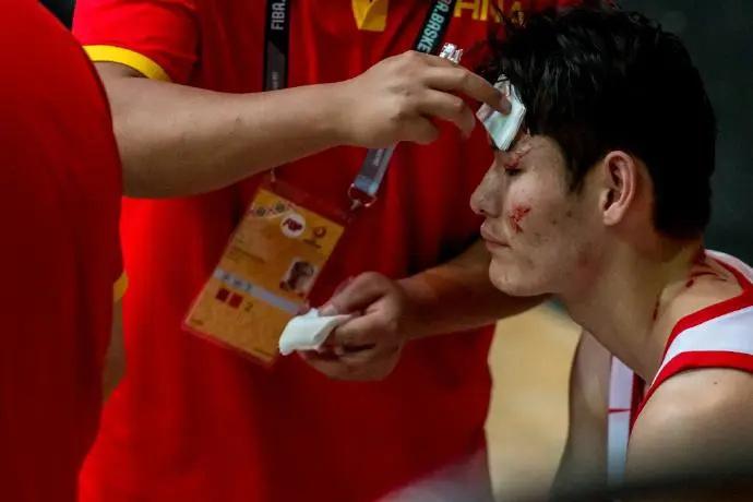 CBA第30屆全明星賽直播免費觀看直播，郭艾倫因眼部傷勢缺席